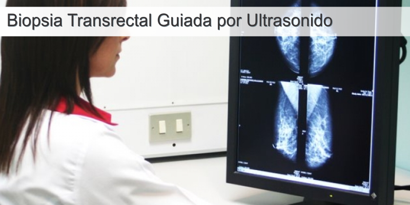 img-Biopsia trans-rectal - Clínica Urologica de Tehuacan