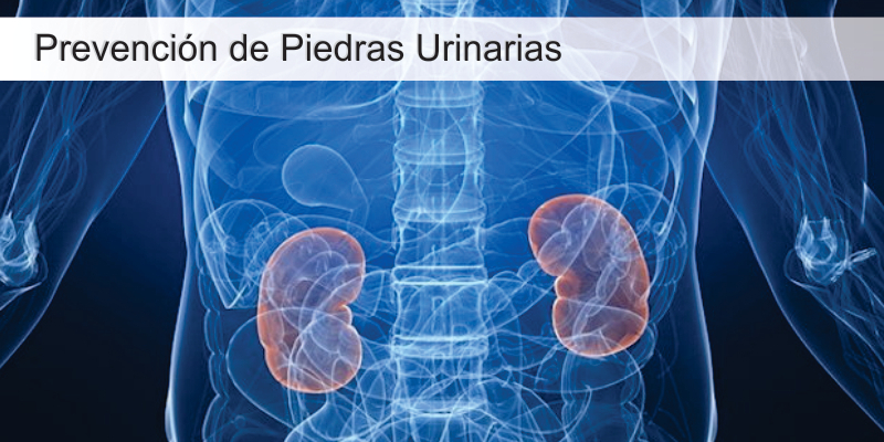 img-Prevencion de piedras urinarias - Clinica Urologica de Tehuacan
